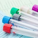 Folate Metabolism Test for MTHFR